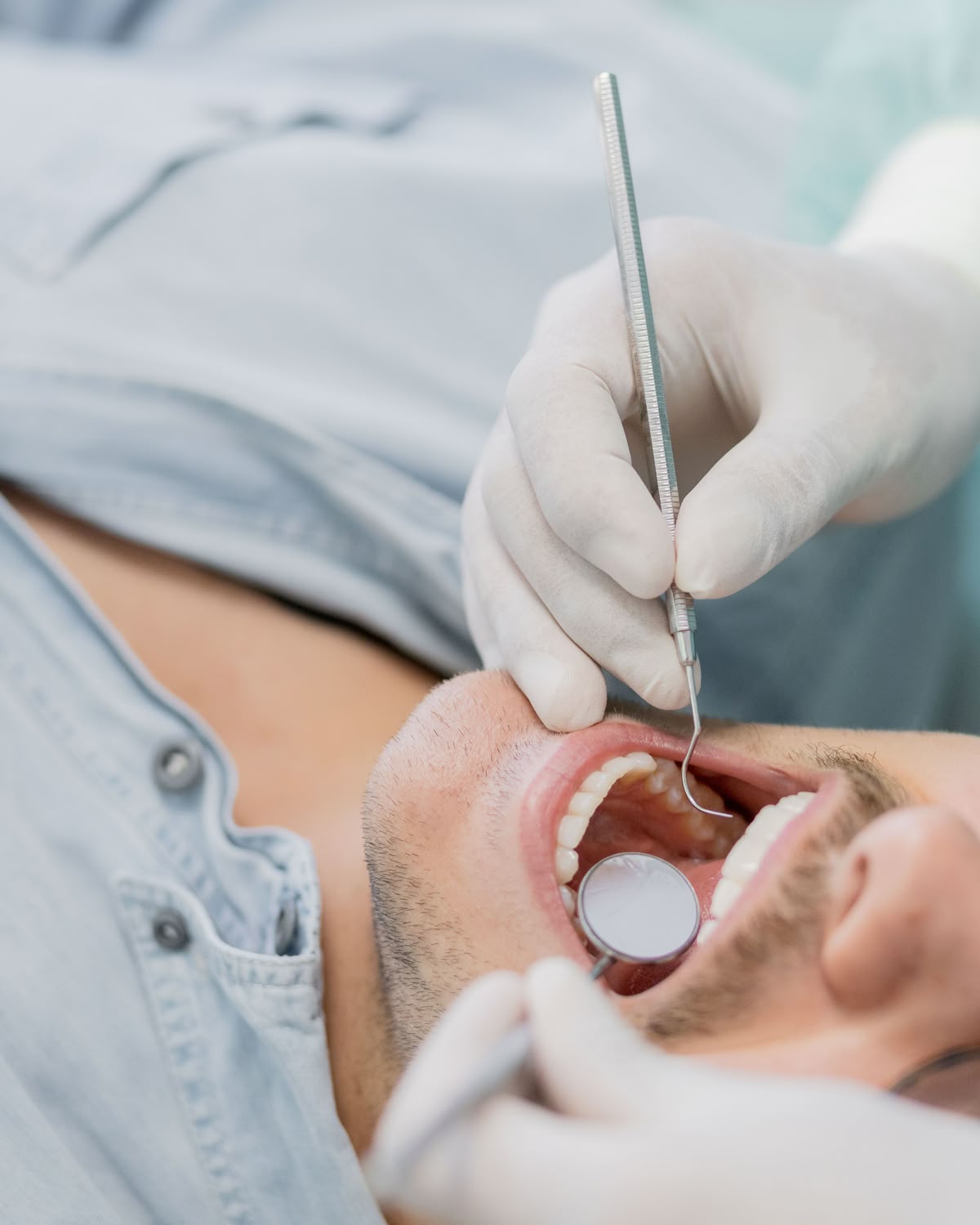 Endodoncia en Nordental